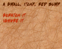 The Itch